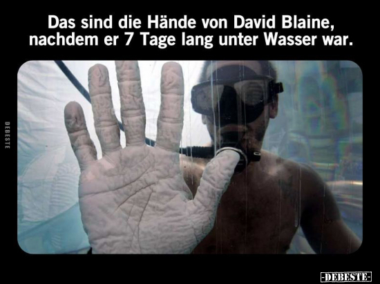 Das sind die Hände von David Blaine, nachdem.. - Lustige Bilder | DEBESTE.de