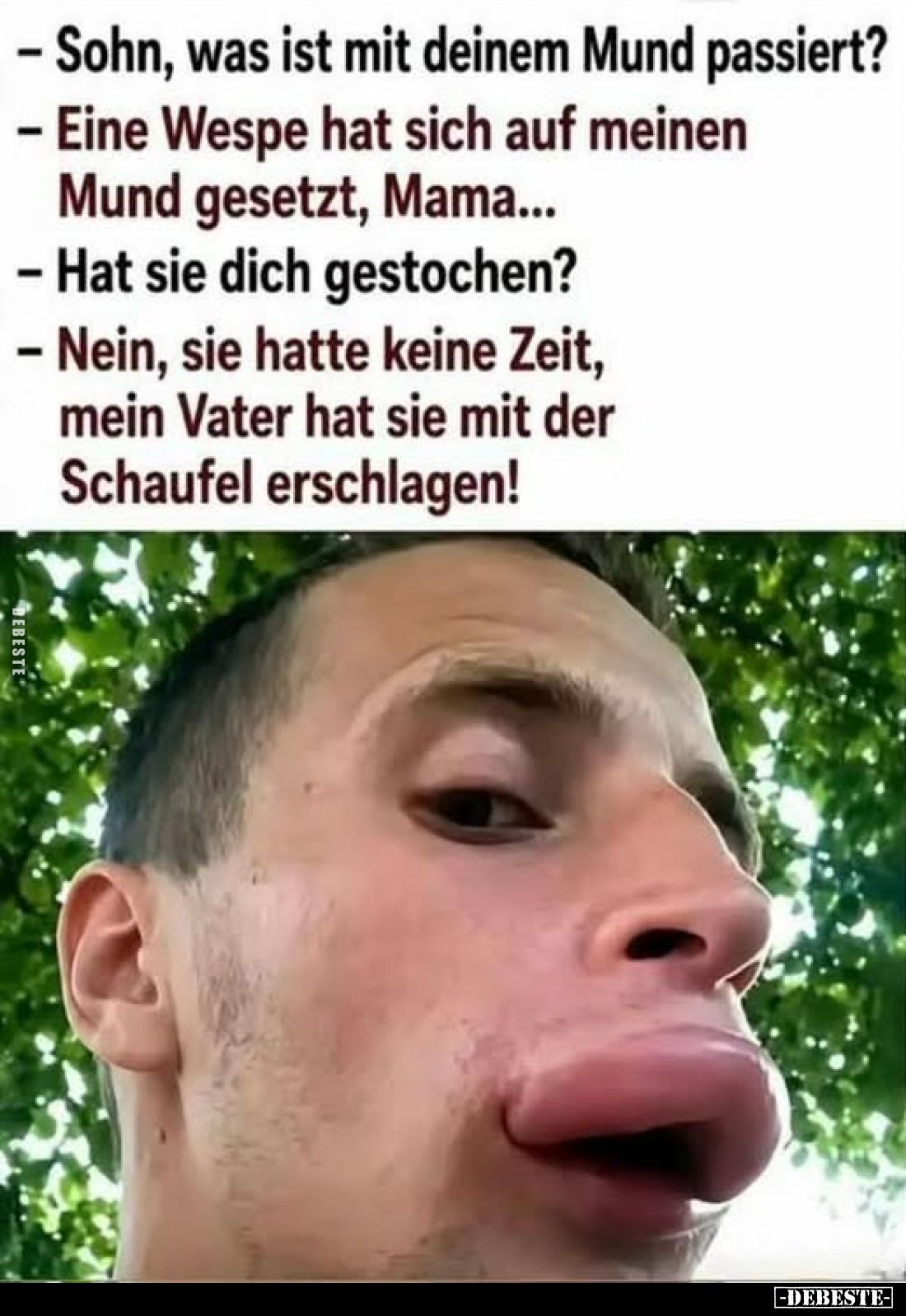 – Sohn, was ist mit deinem Mund passiert?
- Eine Wespe hat sich auf meinen Mund gesetzt, Mama...
- Hat sie dich gestochen?...