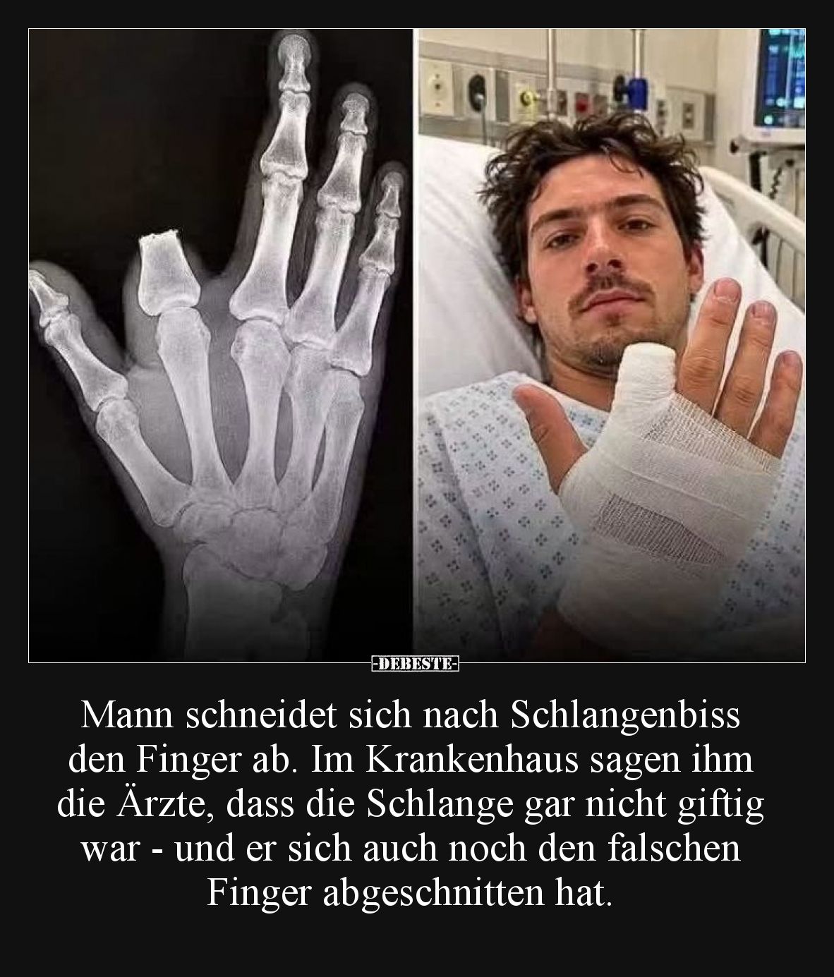 Mann schneidet sich nach Schlangenbiss den Finger ab. Im Krankenhaus sagen ihm die Ärzte, dass die Schlange gar nicht giftig ...