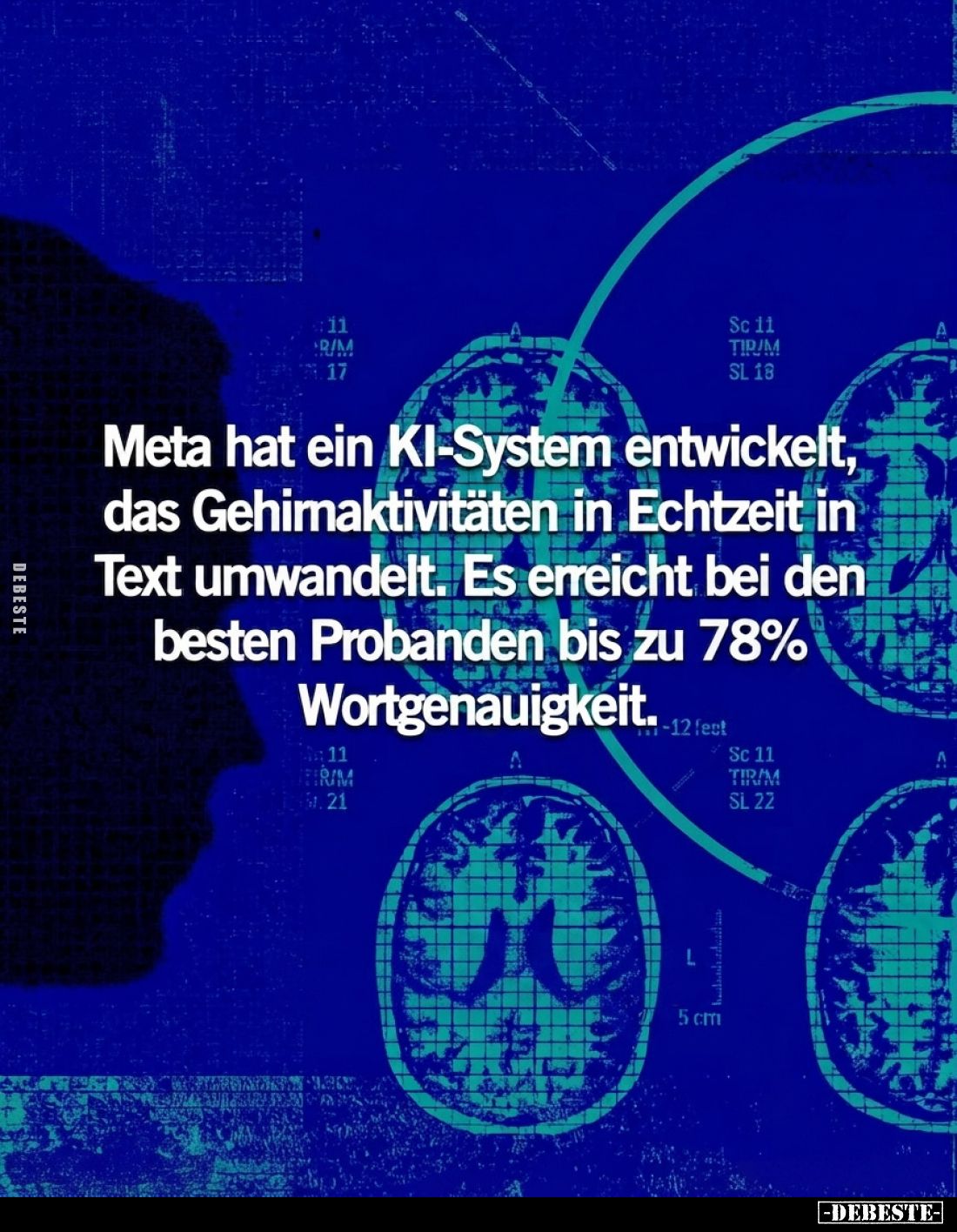 Meta hat ein KI-System entwickelt, das Gehirnaktivitäten in Echtzeit in Text umwandelt. Es erreicht bei den besten Probanden ...