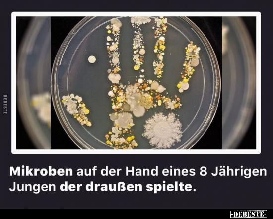 Mikroben auf der Hand eines 8 Jährigen Jungen der draußen.. - Lustige Bilder | DEBESTE.de