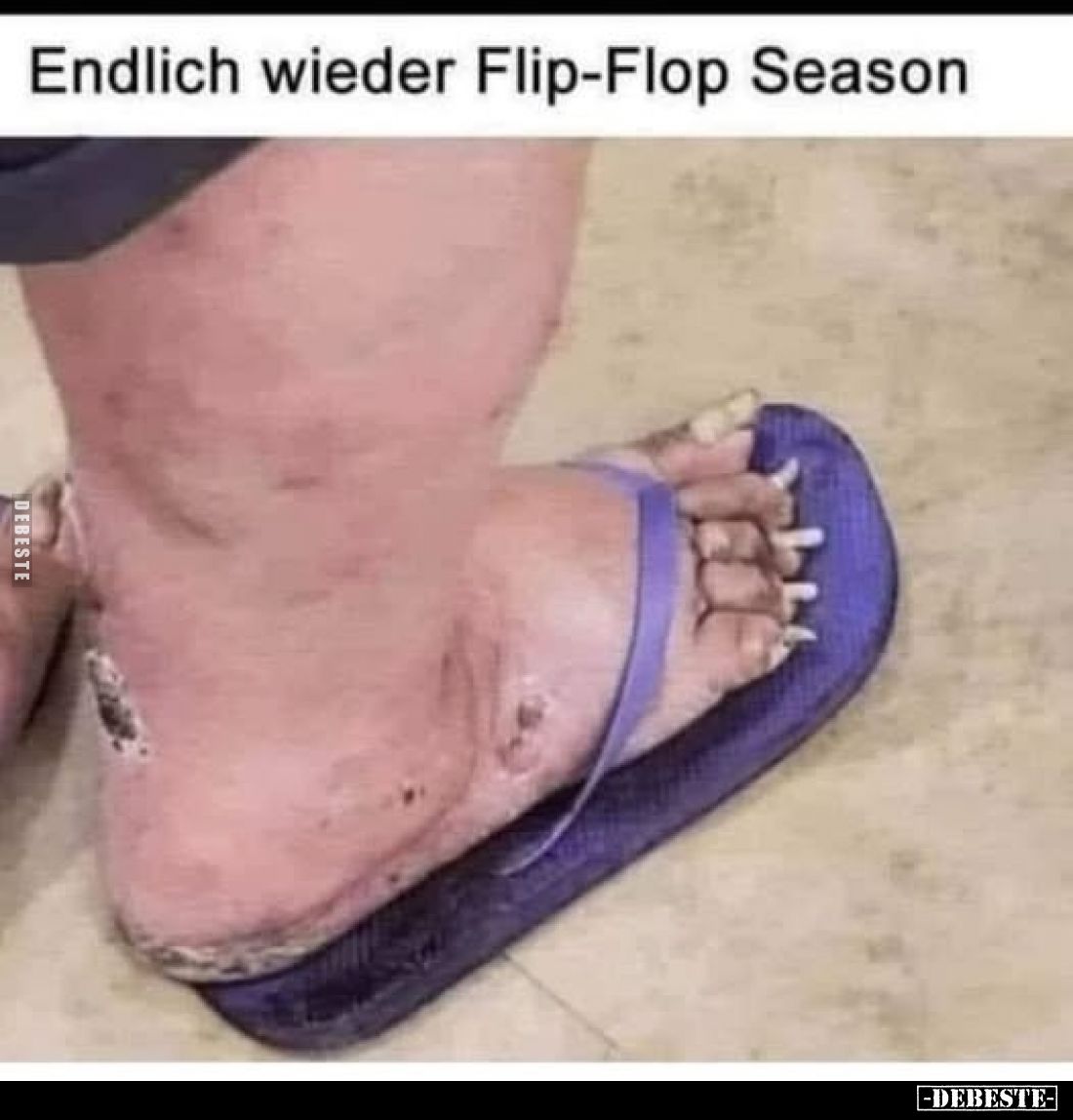 Endlich wieder Flip-Flop Season.. - Lustige Bilder | DEBESTE.de