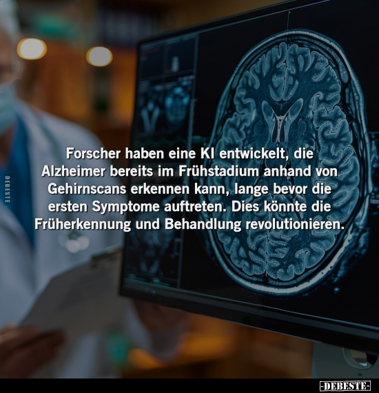 Forscher haben eine KI entwickelt, die Alzheimer bereits im.. - Lustige Bilder | DEBESTE.de