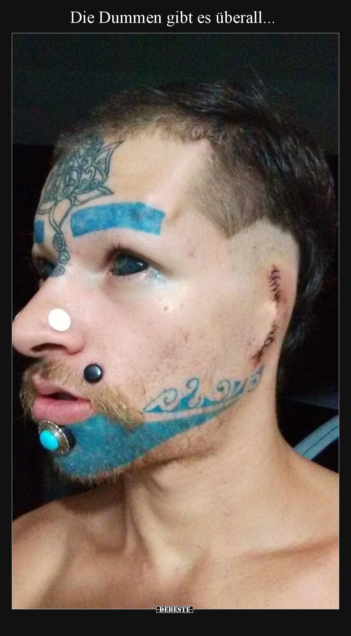 Die Dummen gibt es überall...