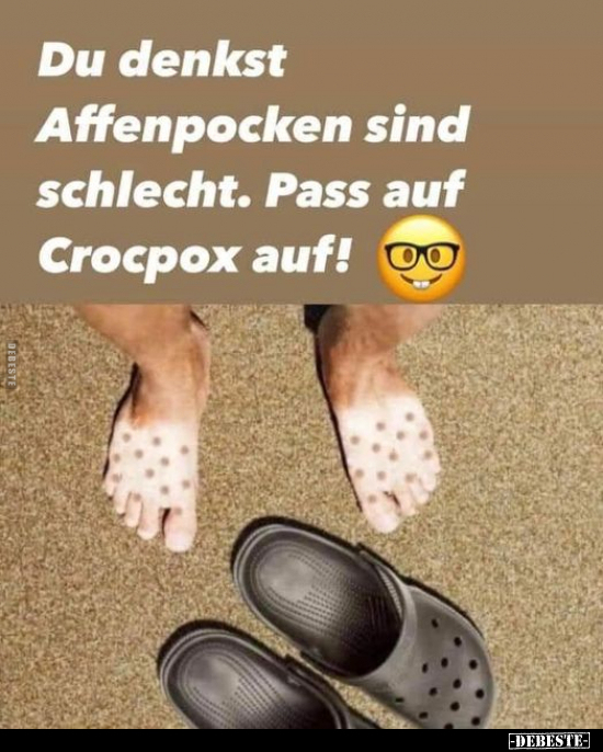 Du denkst Affenpocken sind schlecht. Pass auf Crocpox.. - Lustige Bilder | DEBESTE.de