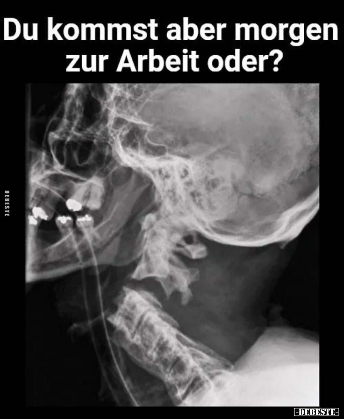 Du kommst aber morgen
zur Arbeit oder?