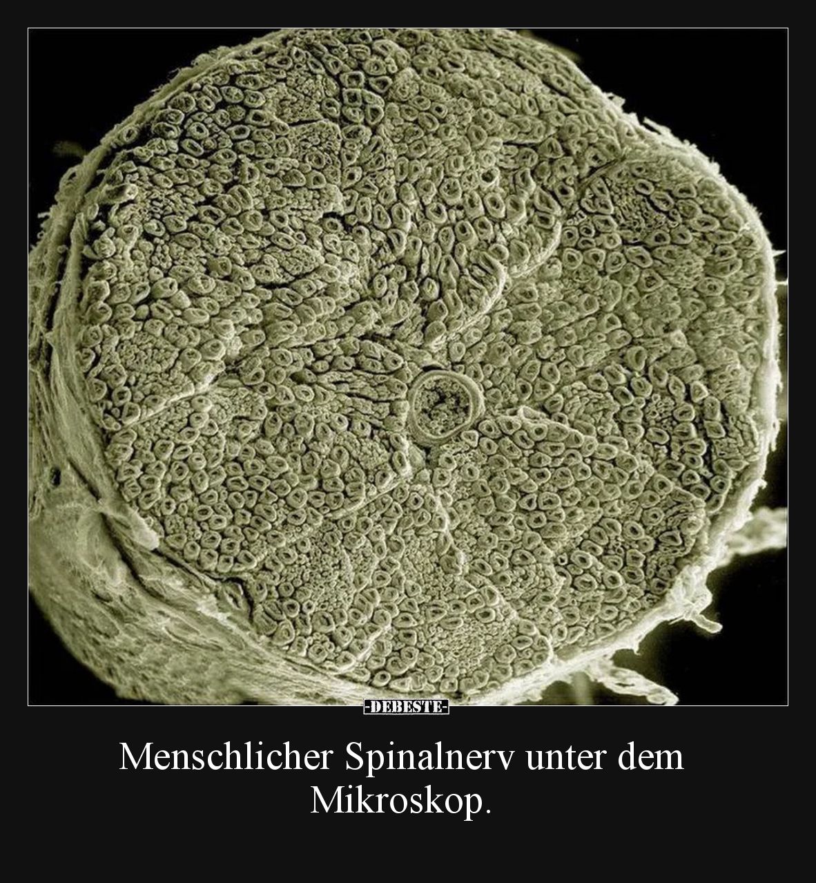 Menschlicher Spinalnerv unter dem Mikroskop.