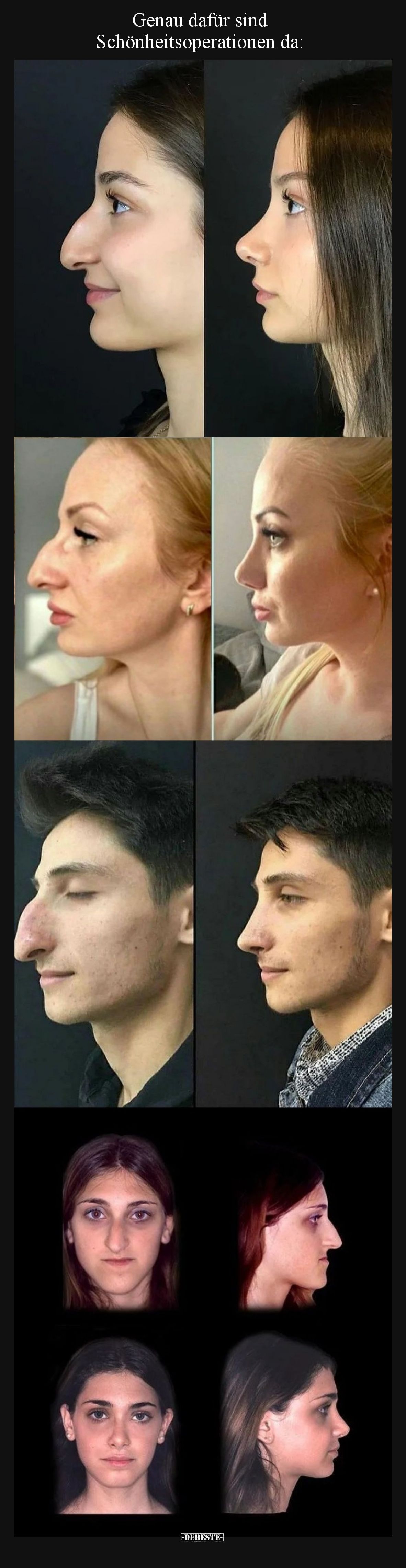 Genau dafür sind Schönheitsoperationen da.. - Lustige Bilder | DEBESTE.de