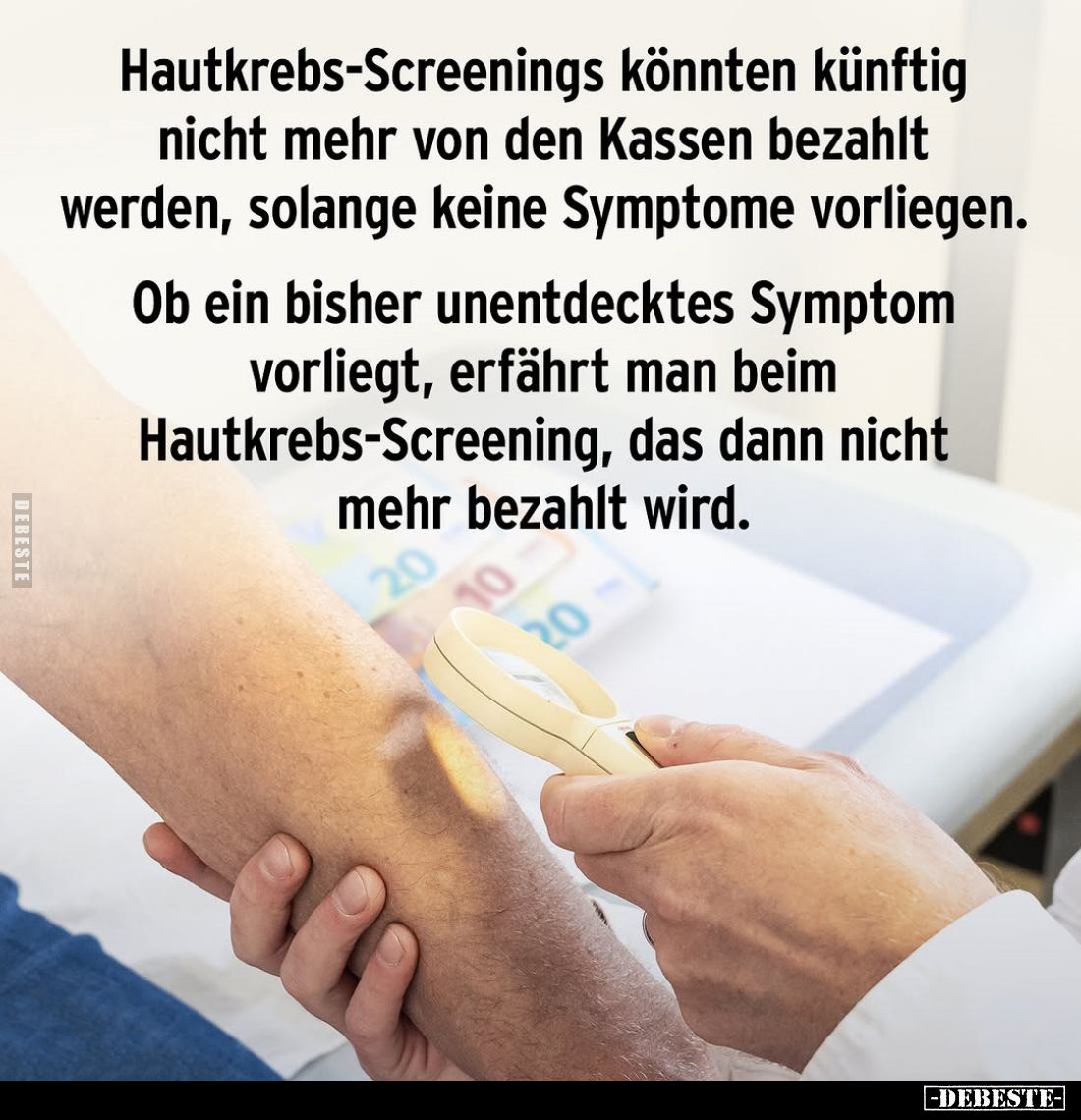 Hautkrebs-Screenings könnten künftig nicht mehr von den Kassen bezahlt werden, solange keine Symptome vorliegen.
Ob ein bish...