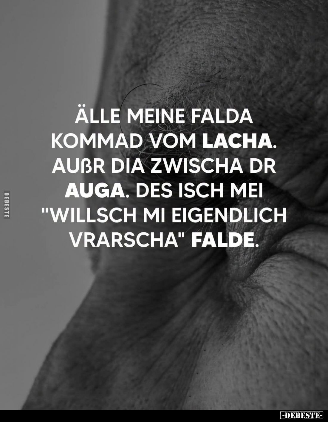Älle meine Falda kommad vom Lacha.
Außr dia zwischa dr Auga.
Des isch mei "willsch mi eigendlich vrarscha" Falde....