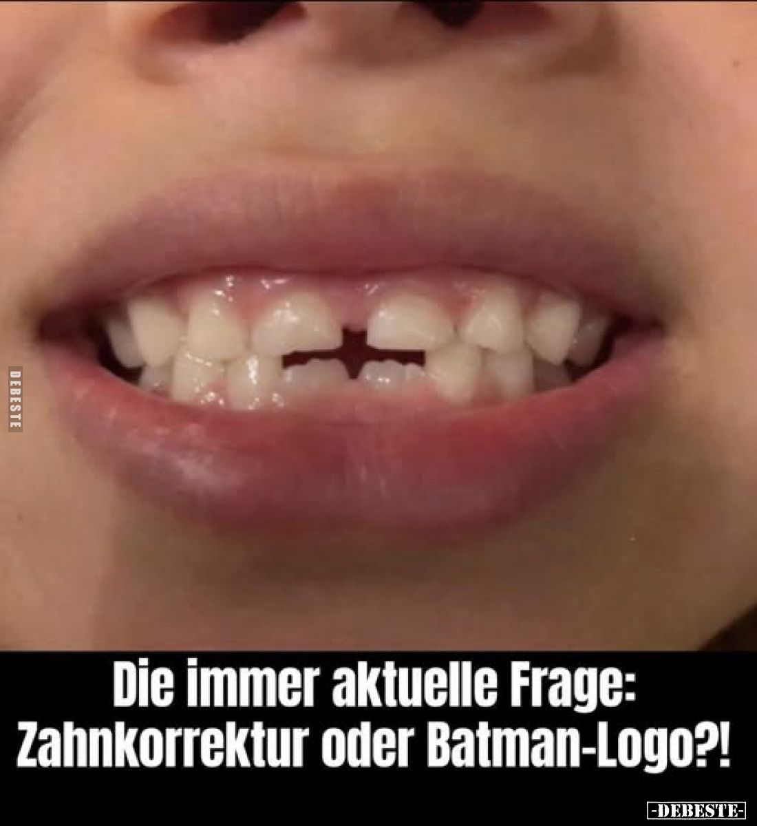 Die immer aktuelle Frage: Zahnkorrektur oder Batman-Logo?!
