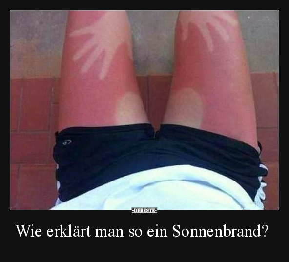 Wie erklärt man so ein Sonnenbrand? - Lustige Bilder | DEBESTE.de