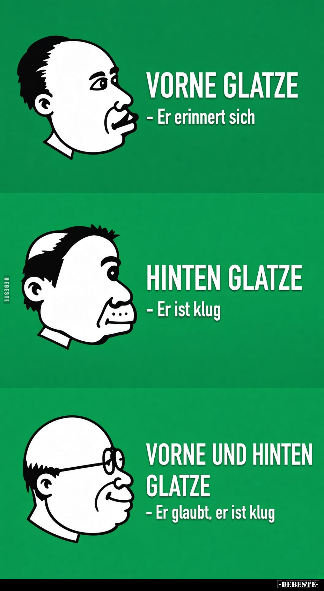 Vorne Glatze: Er erinnert sich. - 
Hinten Glatze: Er ist klug. -
Vorne und hinten Glatze: Er glaubt, er ist klug.