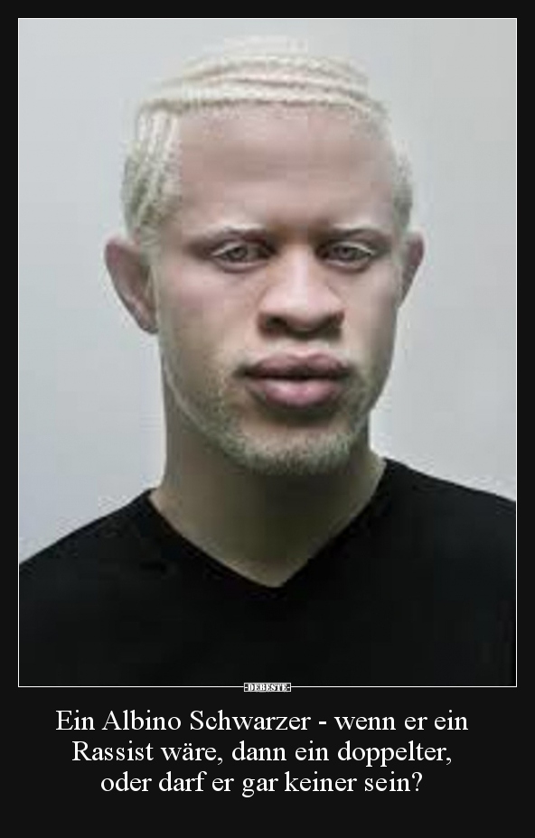 Ein Albino Schwarzer - wenn er ein Rassist wäre, dann ein.. - Lustige Bilder | DEBESTE.de