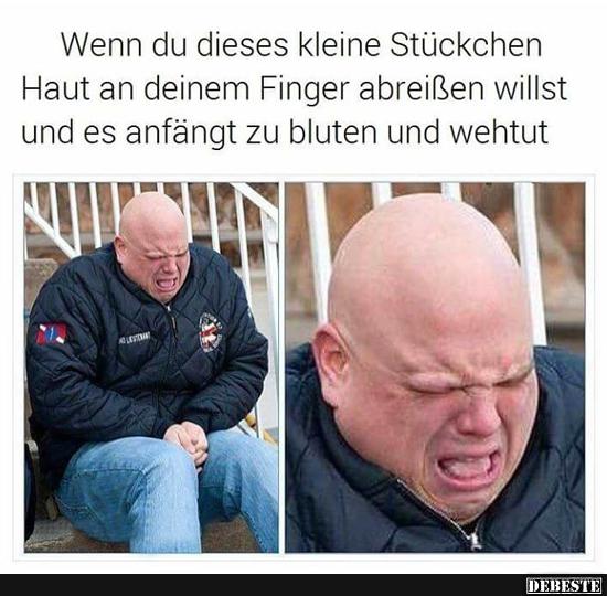 Wenn du dieses kleine Stückchen Haut an deinem Finger..