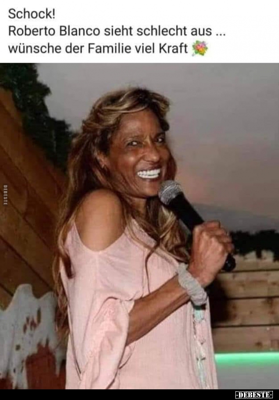 Schock! Roberto Blanco sieht schlecht aus..