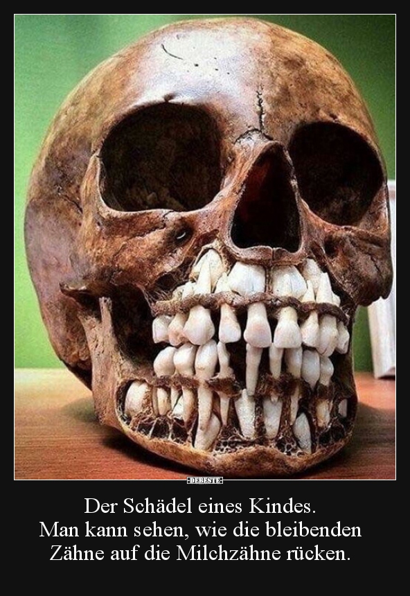 Der Schädel eines Kindes. Man kann sehen, wie die..