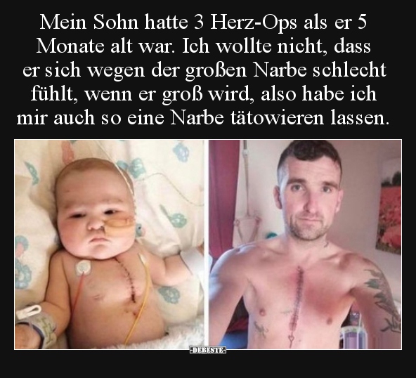 Mein Sohn hatte 3 Herz-Ops als er 5 Monate alt war. Ich..